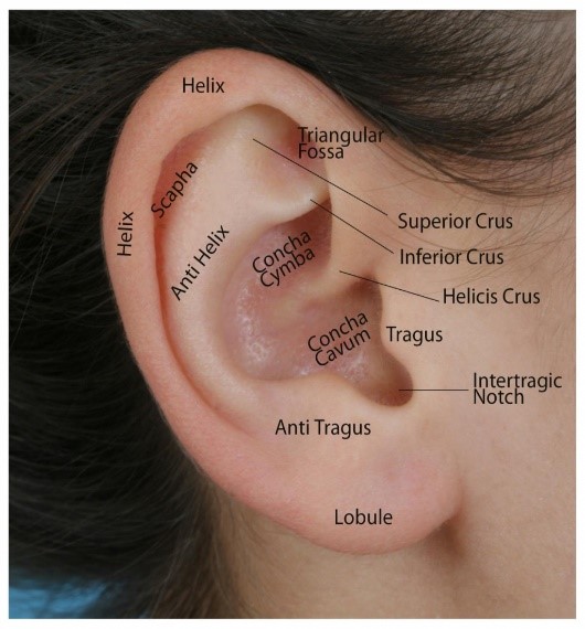 Otoplasty-Ear Pinning
